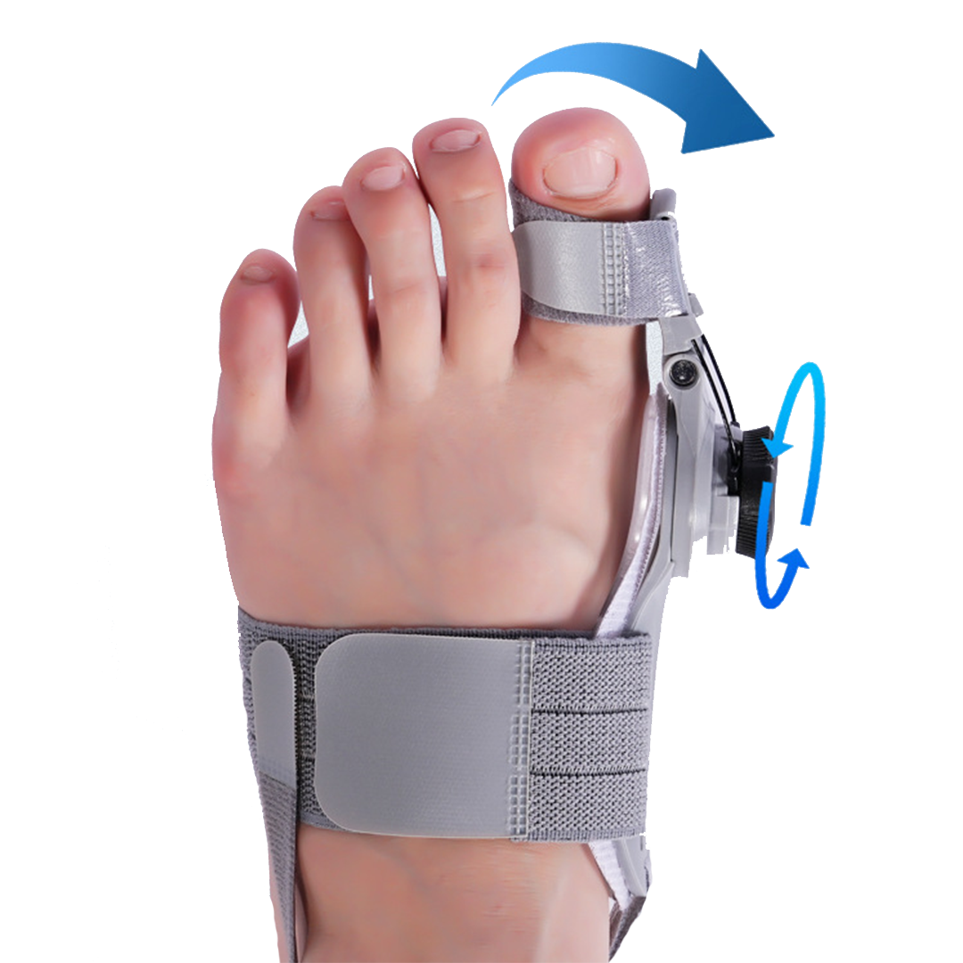 Orthopedische Bunion Fix