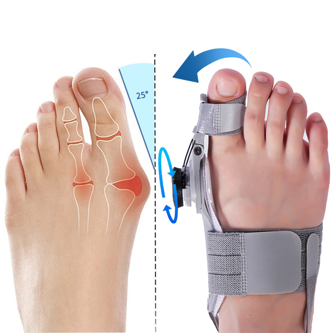 Orthopedische Bunion Fix